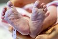 A heel-prick test may be missing newborns at risk of poorer education and development outcomes. 