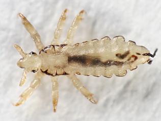 Head louse. Lice. Nits. Thinkstock