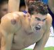 American star Michael Phelps was covered in cupping marks during the 4x100 metre freestyle relay in Rio.