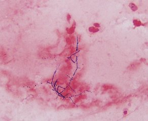 Sepsis bacteria