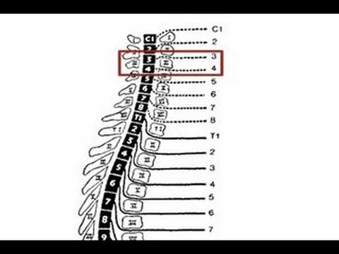 Levels of Function in Spinal Cord Injury