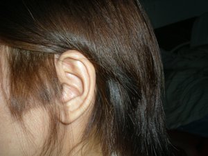 A left ear , August 28, 2010.