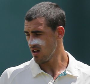 Training mishap: Mitchell Starc.