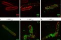 E-coli bacteria being attacked by peptide polymers designed by Shu Lam, a PhD student at Melbourne University.