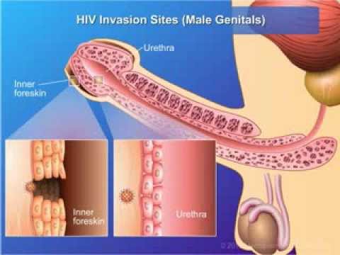 Transmission and Prevention of HIV