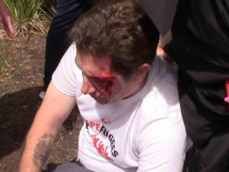 An anti-Muslim protester relaxes after a day of bleeding and getting stomped during a rally in Melbourne, Australia on Saturday.