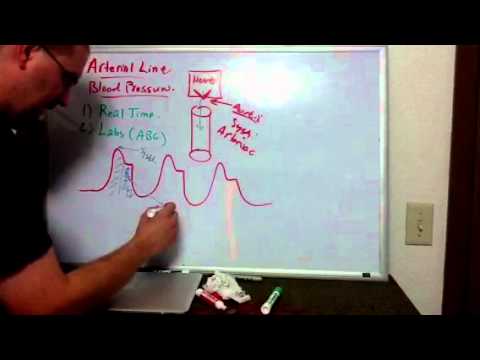 Haemodynamics Part 6: Arterial Line