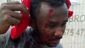 WARNING GRAPHIC IMAGE. Masoud Ali Shiekh, 31, Somalia aid worker based on Manus Island. Credit: Matthew Abbott