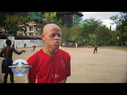 Tanzania's Albino United on Trans World Sport