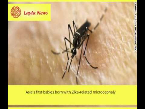 Asia's first babies born with Zika-related microcephaly |  By : CNN