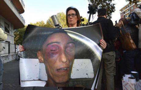 Ilaria Cucchi, Stefano’s sister, showing a photo of her brother’s body.