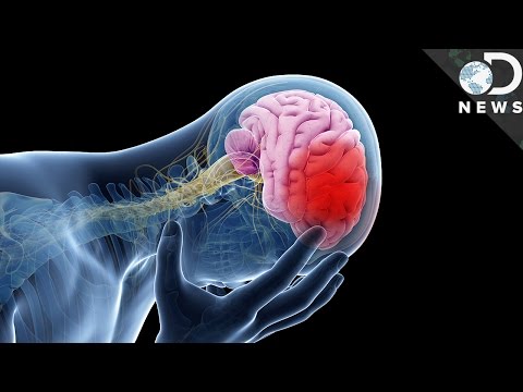 This Is What A Stroke Does To Your Body