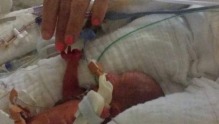 Billie Ava Stevens was born at just 25 weeks.