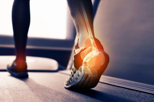 Injury is heartbreaking for  runners, but the right rehab can get you back on your feet. 