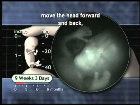 Window on the Womb: 8 to 11 Weeks