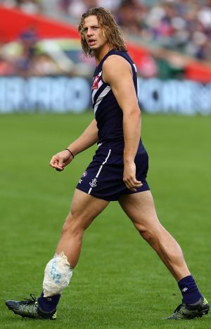 Docker Nathan Fyfe leaves the field at three-quarter time huddle with an ice pack on his left leg.