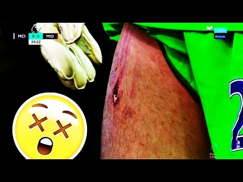 Victor Valdes vs Manchester City (Away - 05.11.2016) ★ Horror Tackle ★