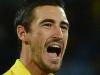 ‘You could see bones’: Starc’s gruesome injury