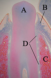 Eruptingtoothwithlabels11-24-05.jpg