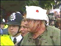 An injured protester