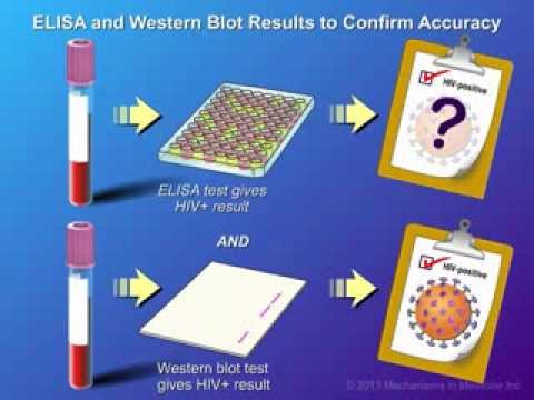 Diagnosis and Testing of HIV Infection