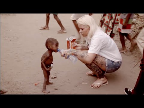 Starving Child Abandoned because of "Witchcraft" Rescued by Aid Worker