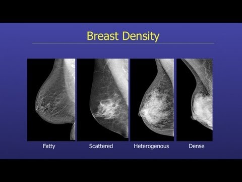 Breast Imaging Options and Issues for Women under Age 40