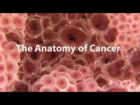 What is cancer?