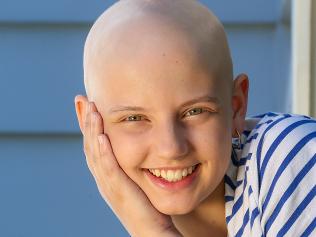 Girl speaks out about alopecia