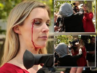 Bloody hell! TV journo attacked