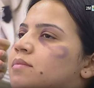 Moroccan TV station 2M airs makeup tips for hiding domestic violence.