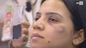 Moroccan TV station 2M airs makeup tips for hiding domestic violence.