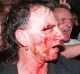 The 1996 Parliament House riot turns bloody.