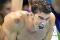 American star Michael Phelps was covered in cupping marks during the 4x100 metre freestyle relay in Rio.