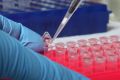 Researchers have found that simply reversing the order of surgery and immunotherapy in cancer patients can improve ...