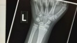 Claims a child's x-ray was left unread for weeks