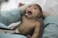 Lara was born with microcephaly in a hospital in Brazil.  When indications mounted that the increase in microcephaly was ...