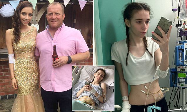 Girl may never be able to eaTagain after stomach left paralysed from gastroparesis