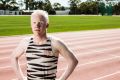 Sprinter Chad Perris says albinism has not stopped him from training outside in the scorching summer heat.