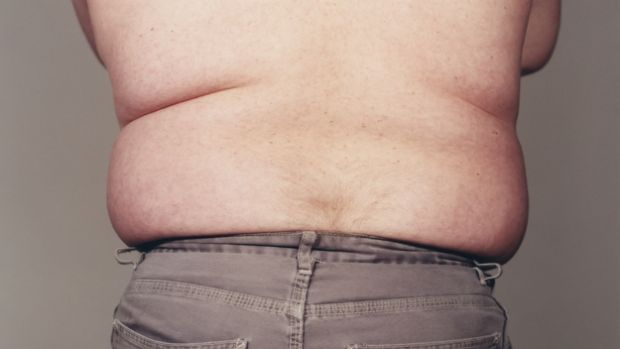 Turn-around: From fat-shamer to apologiser.