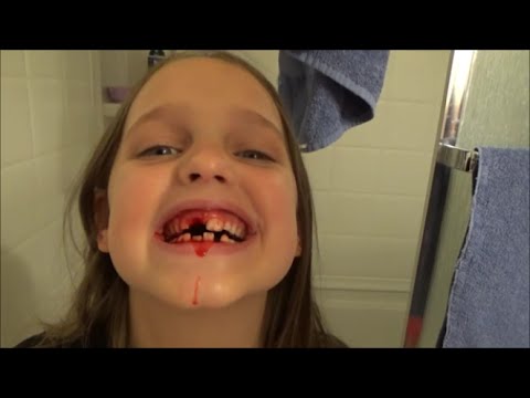 Annabelle Bloody Tooth Falls Out #4  Victoria Freak Family Vlogs