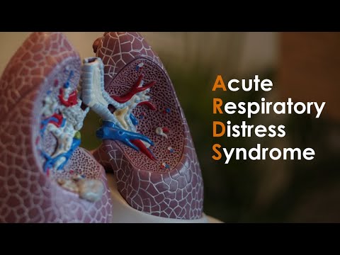 Acute Respiratory Distress Syndrome (ARDS) for USMLE Step1 and USMLE Step 2