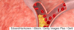 ANTIATHEROSCLEROTIC EFFECT