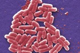 The Nevada woman had  up a variant of a germ called Klebsiella pneumoniae, probably while she was treated in India for a ...