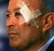 Eddie Jones gave two explanations for his injured face.