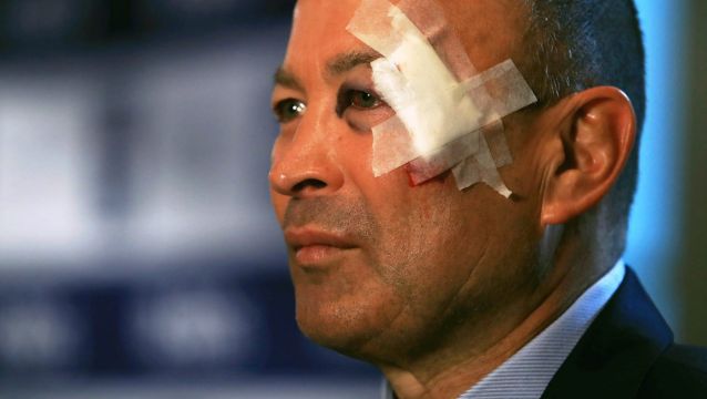 Eddie Jones gave two explanations for his injured face.
