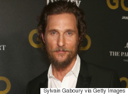 Matthew McConaughey Says He Found The Miracle Cure To Balding