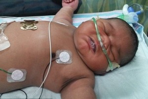 Baby Loyalty was in NICU for 27 days.
