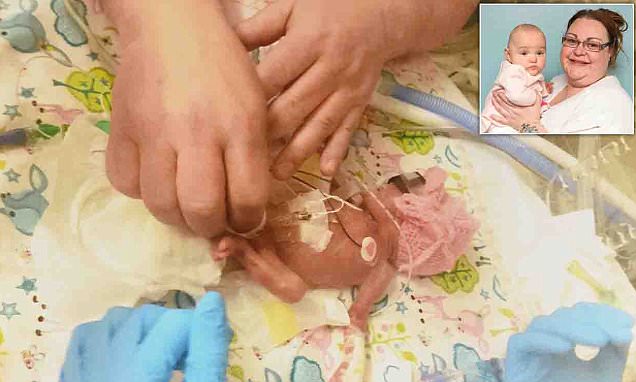 Baby whose feet were the size of a penny was SAVED