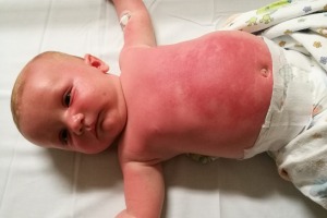 Jessie Swan says her son developed a rash after using the sunscreen.
